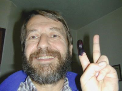 Richard with purplish finger